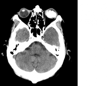 EURORAD - Radiologic Teaching Files