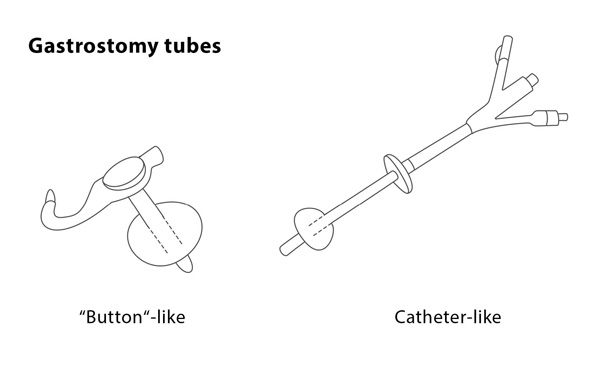 Find The Right Cpt Code Laparoscopic Gastrojejunostomy Tube Placement - r3ujkzn